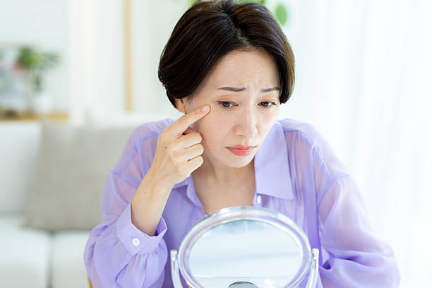 シワとは？原因や種類、予防法、皮膚科での治療を解説